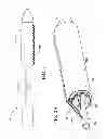 Fig. 02 - External steerable fiber for use in endoluminal deployment of expandable devices