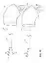 Fig. 08 - External steerable fiber for use in endoluminal deployment of expandable devices