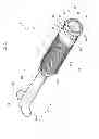 Fig. 02 - Prosthetic vascular conduit and assembly method