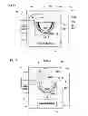 Fig. 07 - Implantable biological joint replacement