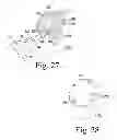 Fig. 13 - Implant insertion tool for use in a surgical procedure to implant a stemless humeral component