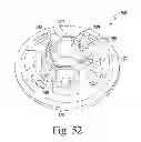 Fig. 28 - Implant insertion tool for use in a surgical procedure to implant a stemless humeral component