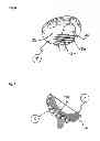Fig. 08 - Humeral component of a shoulder prosthesis
