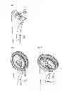 Fig. 16 - Humeral component of a shoulder prosthesis
