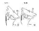 Fig. 17 - Humeral component of a shoulder prosthesis
