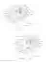 Fig. 07 - METHODS OF USING, PROVIDING AND MANUFACTURING A SHOULDER PROSTHESIS WITH A ONE-PIECE HUMERAL HEAD