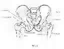 Fig. 02 - COMPUTER-GUIDED SYSTEM FOR ORIENTING THE ACETABULAR CUP IN THE PELVIS DURING TOTAL HIP REPLACEMENT SURGERY