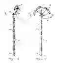 Fig. 02 - Cation exchange ureteral stent