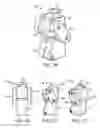 Fig. 02 - POLYCENTRIC KNEE JOINT PROSTHESIS FOR EXTREME AFFORDABILITY