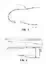 Fig. 02 - Method of digitally constructing a prosthesis