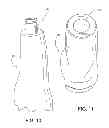 Fig. 08 - Method of digitally constructing a prosthesis