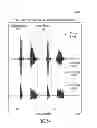 Fig. 45 - Vibration sensor and acoustic voice activity detection systems (VADS) for use with electronic systems