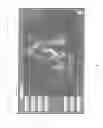 Fig. 07 - Systems and methods for using a touch-sensitive display unit to analyze a medical image