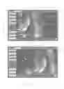 Fig. 09 - Systems and methods for using a touch-sensitive display unit to analyze a medical image