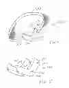Fig. 05 - Sleeve Accessories and Related Methods