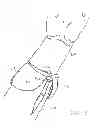 Fig. 08 - Sleeve Accessories and Related Methods