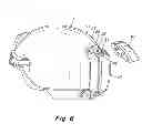 Fig. 07 - Battery pack and helmet mounting arrangement