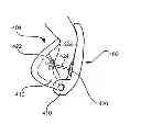 Fig. 01 - Ear protection device for athletes