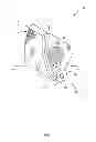 Fig. 02 - Ear protection device for athletes