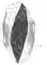 Fig. 05 - Pillow protector
