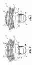 Fig. 04 - Brush with rotatable handle