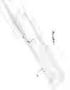 Fig. 11 - Paint roller