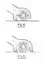 Fig. 08 - Cleaning device for cleaning a surface comprising a brush and a squeegee element