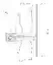 Fig. 04 - Composite clamp