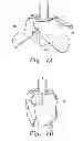 Fig. 08 - Portable alarm system for coffins