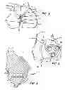 Fig. 03 - Marking template for installing a custom replacement device for resurfacing a femur and associated installation method