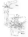 Fig. 05 - Marking template for installing a custom replacement device for resurfacing a femur and associated installation method