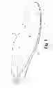 Fig. 02 - Weighted shoe insole and method for making the same