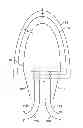 Fig. 01 - String Bug Light Termination System