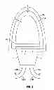 Fig. 03 - String Bug Light Termination System