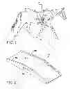 Fig. 02 - EXTERNAL LATERAL THORACIC VESSEL PROTECTOR