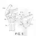 Fig. 04 - Adjustable wrench
