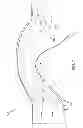 Fig. 04 - Liquid injection inlet particle separator systems and methods