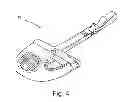 Fig. 05 - HORSE MUZZLE AND METHODS OF USE