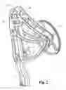 Fig. 03 - Compound bow system
