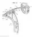 Fig. 03 - Archery Bows and Archery Bow Components