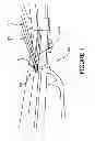 Fig. 02 - Crossbow cable saver
