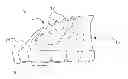 Fig. 01 - Device and Methods for Treatment of Bruxism and TMJ Disorder