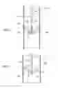 Fig. 03 - Drain pipe cleaning device and method