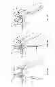 Fig. 05 - Valve control mechanism and method