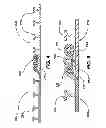 Fig. 04 - Method for controlling creep in spirally expandable profile