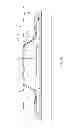 Fig. 04 - ANNULAR BARRIER WITH COMPENSATION DEVICE