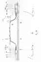 Fig. 07 - ANNULAR BARRIER WITH COMPENSATION DEVICE