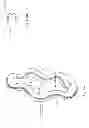Fig. 03 - Extrusion preventing supporting device