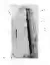 Fig. 03 - Latch Mechanism of a Protective Case for Portable Electronic Device