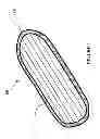 Fig. 03 - INFLATABLE CASE TO TRANSPORT A SPORTS BOARD AND A METHOD FOR MAKING THE SAME